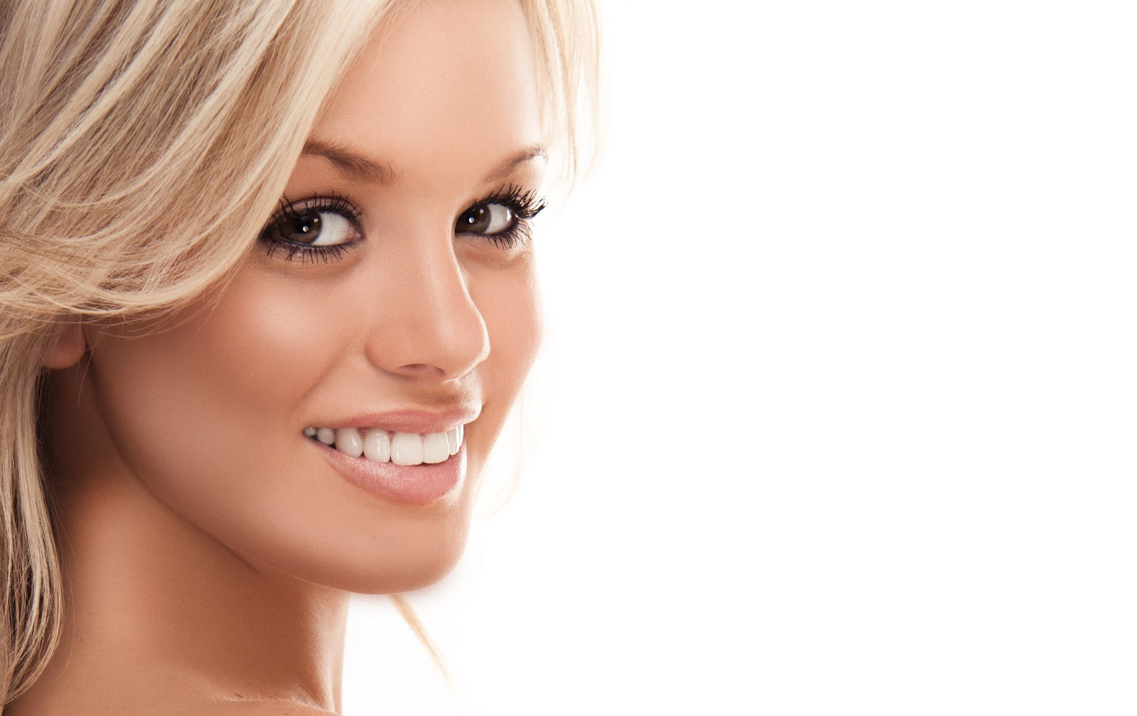 Smile Makeover